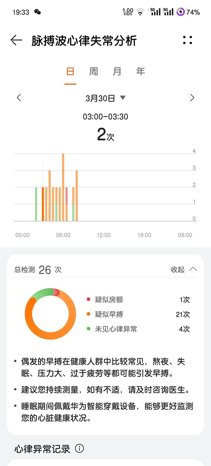 a86ba501c98465d61232148873ee81ea4b340e6e